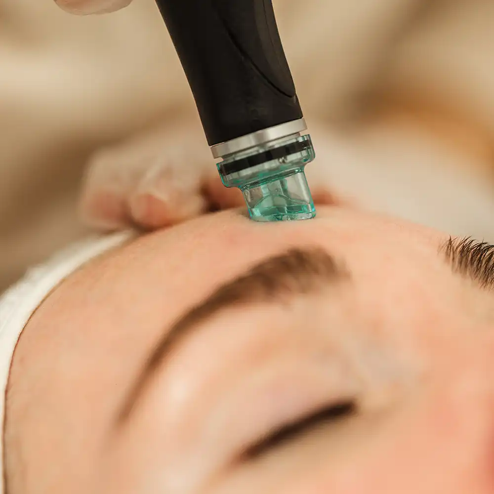 Hydrafacial mit unscharfem Vorder- und Hintergrund